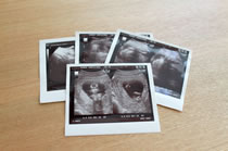 �n�K�L��G�A�G�R�[�ʐ^�Ȃǁi�ő�A4�T�C�Y�A���ʂ̎��Ɍ���܂��j